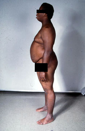 spondylo2.jpg