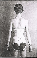 Balgrist dorsal.jpg
