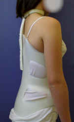 970814_cyphose3.jpg