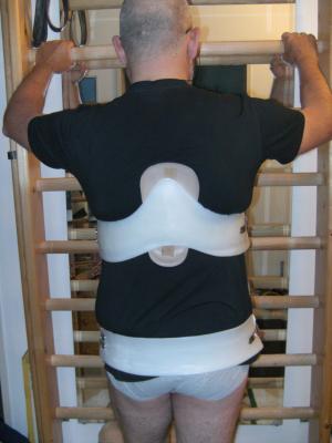 Die TüKO von hinten. Unter die dorsale Kyphosenspange habe ich mit mit Klett eine BAUERFEIND Gel-Pelotte eingeklemmt, welche den Druck auf den Kyphosebeich deutlich erhöht, aber die Trageeigenschaften nochmals verbessert.