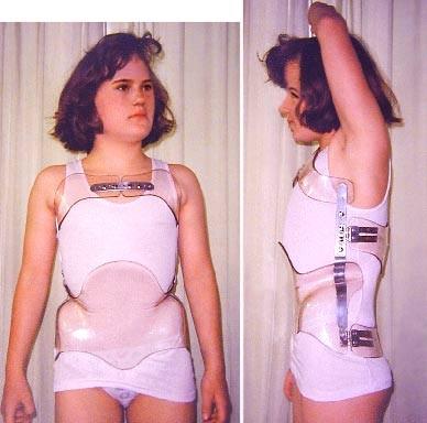Hier ein "klassisches" Plexiglas-TüKO  an einer jungen Dame.