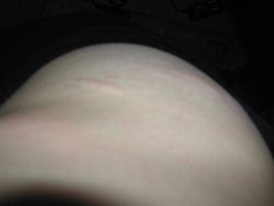 rechte Seite