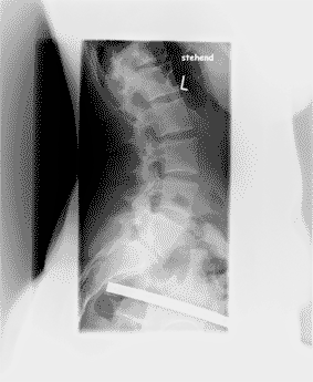 2.gif