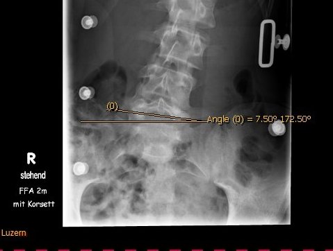 20.04.2006 Sacrum.jpg