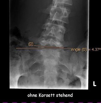03.02.2006 Sacrum.jpg