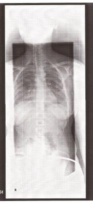frontal.jpg