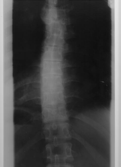 vor ca. einem Jahr von einem anderen Orthopäden - von Vorne