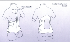 Becker-Gschwend.jpg