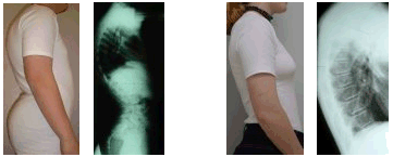 Morbus01.gif
