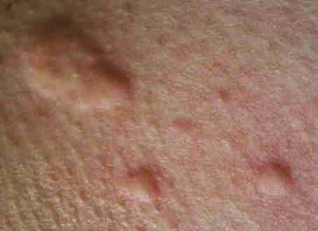 Bauch-01.JPG