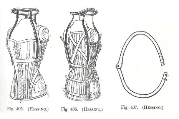 Hessing_11_kl2.JPG