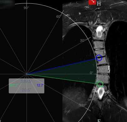 scoliosis_2024.png