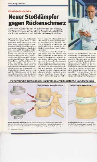 Kuenstl.Bandscheibe.jpg