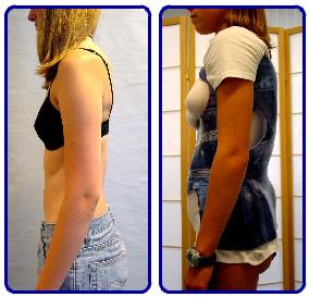 Profil des RSC-Brace