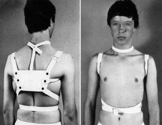 Französische Anti-Rundrücken-Bandage