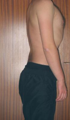 Standaufrechtlateral1klein.jpg